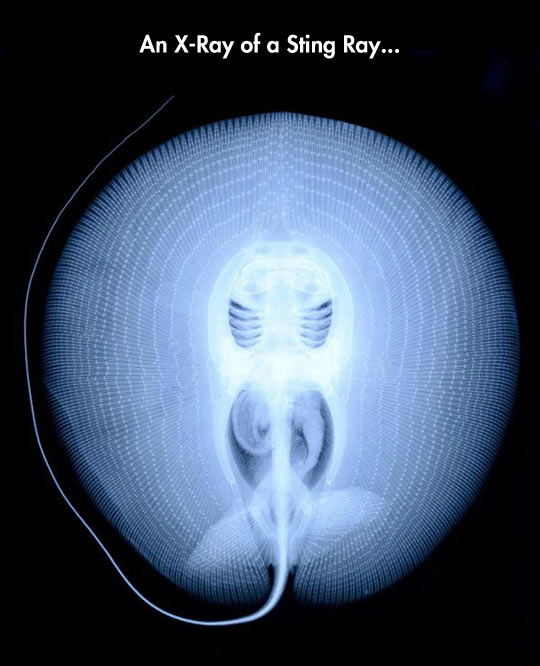 The Beautiful Structure Of A Sting Ray