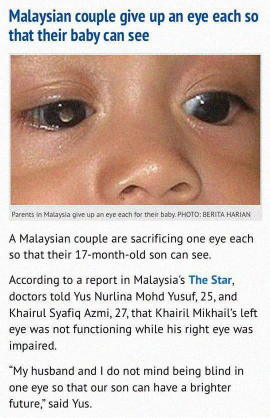 cool-blind-baby-donation-eyes-parents