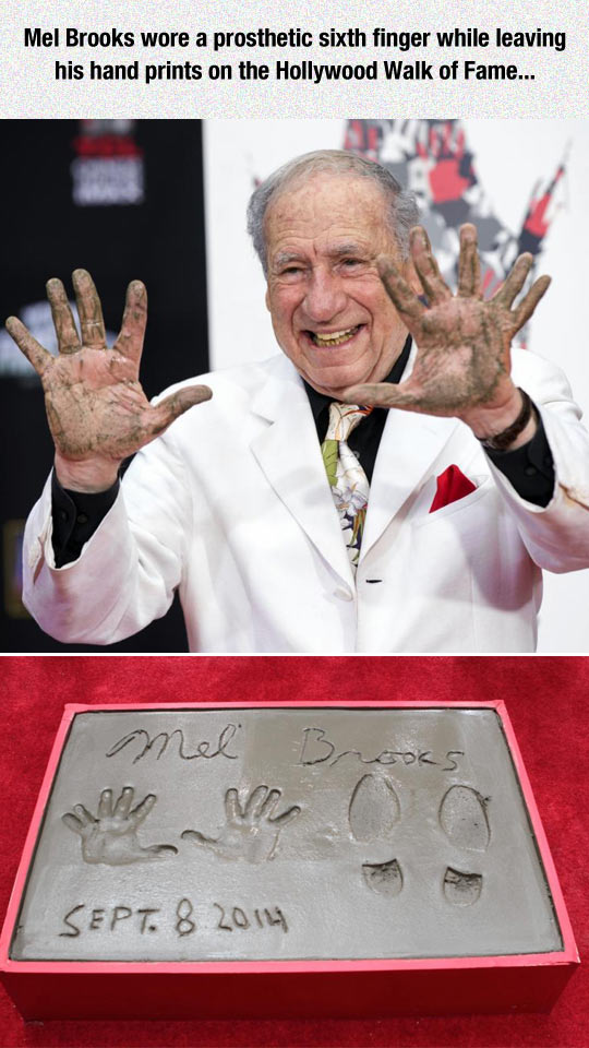 funny-Mel-Brooks-sixth-finger