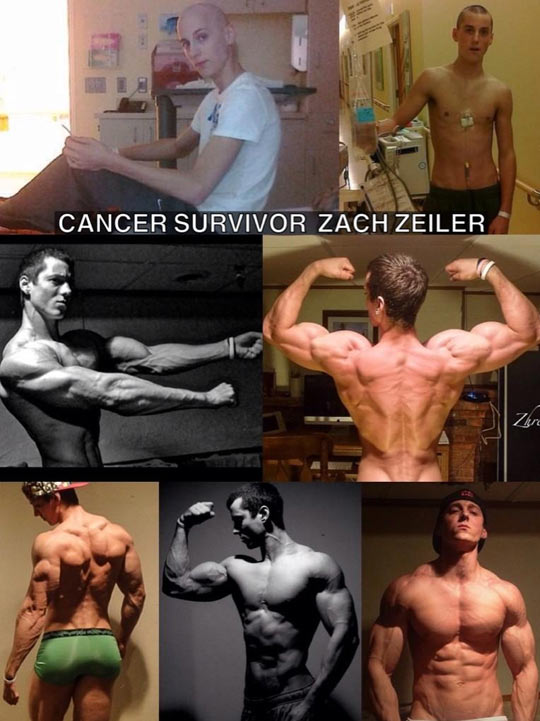 Cancer Survivor Incredible Recovery