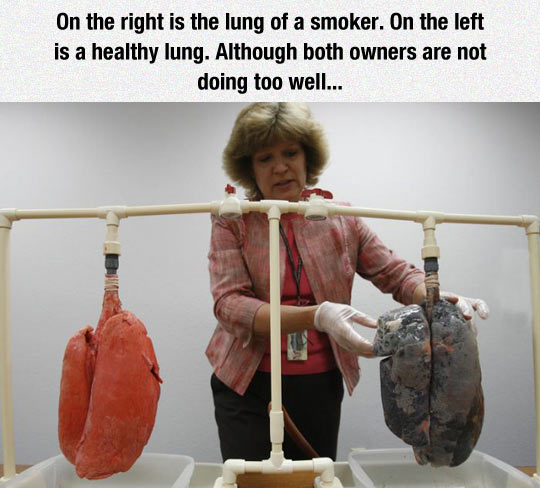 funny-healthy-lung-smoker-doctor