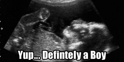 funny baby ultrasound pictures