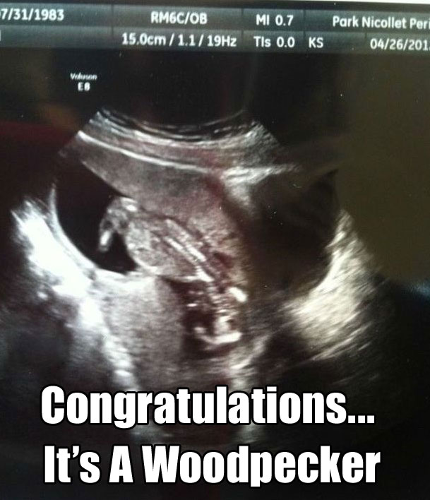 Ultrasound funny pictures