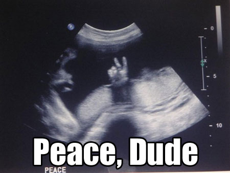 peace-dude-sonogram