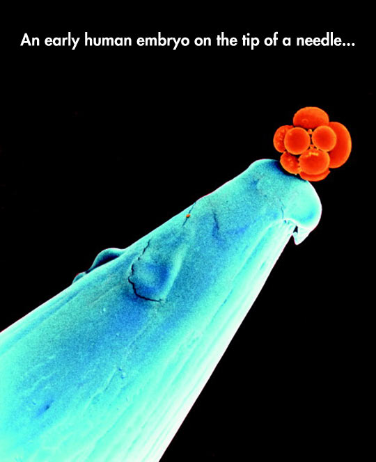 funny-human-embryo-tip-needle