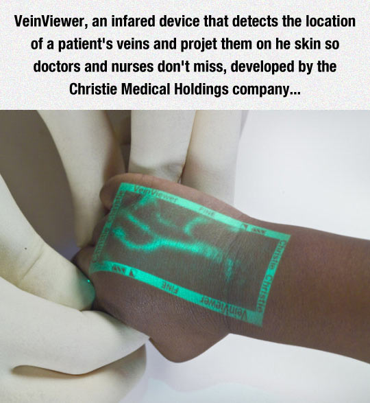 funny-VeinViewer-scan-x-ray