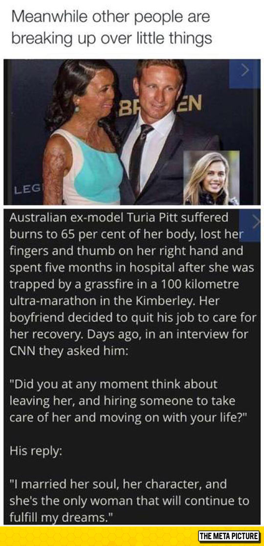 cool-Turia-Pitt-before-after-skin