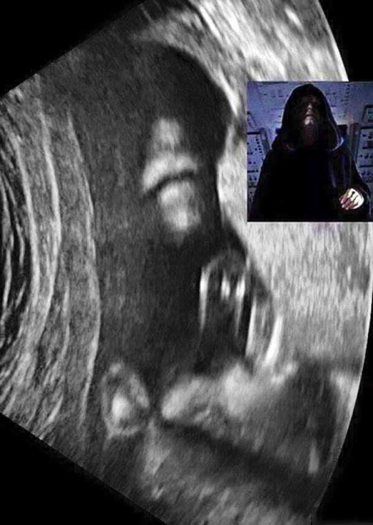 When Your Baby Is Born As A Sith